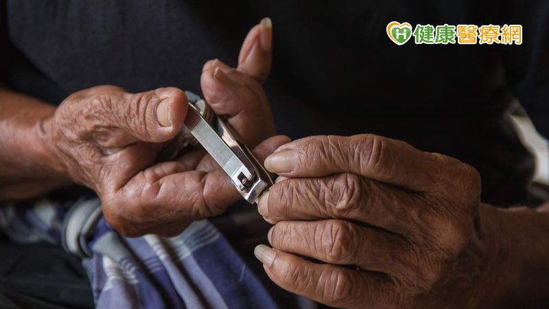 7旬老翁「雙眼紅腫發炎」竟是失智忘剪指甲 醫籲:正視長者失智議題