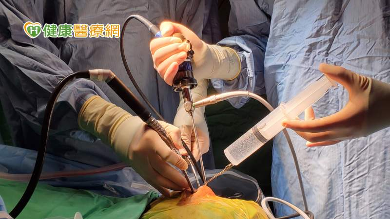 持續鼻塞可能是「嗅覺母神經細胞瘤」! 北榮助49歲男順利根除、保留嗅覺
