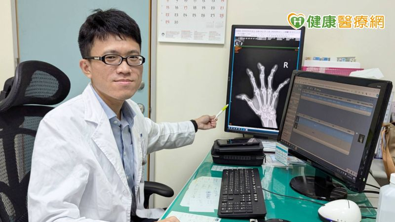 類風濕性關節炎別亂「補」!醫破迷思:這 3 種營養素要吃夠