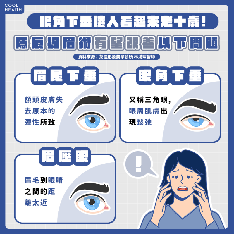 眼角下垂讓人看起來老十歲!上臉老化問題該如何解決?