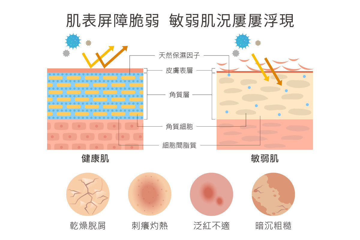 如果肌膚屏障脆弱,則會衍生肌膚乾癢、泛紅等不適問題。(圖/Dr.HUANG生醫團隊)