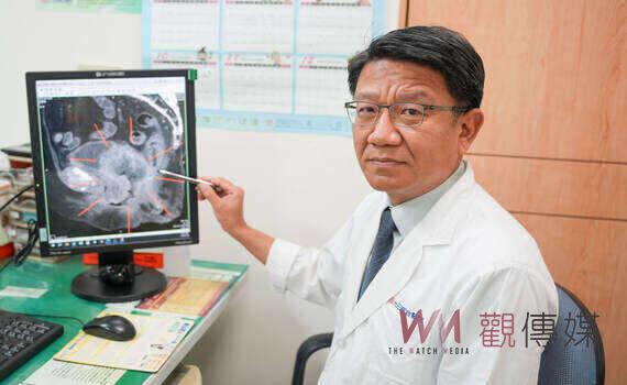 八旬嬤戰勝子宮頸癌末期 醫:停經後仍須抹片檢查 慎防癌變