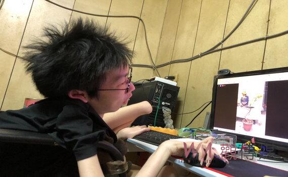肌肉萎縮重症逆轉人生 找到事業新機會