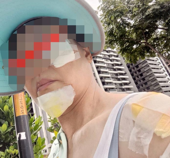 桃園文化局說明婦人摔傷事件 持續協調理賠積極處理 18 wp 17308783056394264283339032286761
