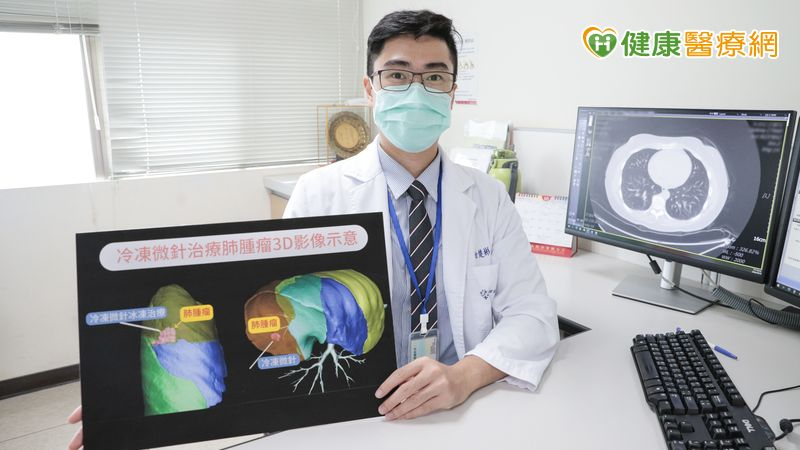 76歲婦人罹慢性病又得肺癌 「微侵入性治療」成功滅癌