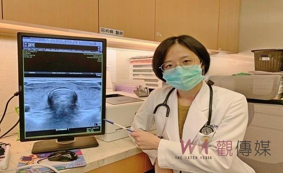 婦女不用驚　「甲狀腺亢進或低下」與「甲狀腺癌」無正相關  可放心備孕