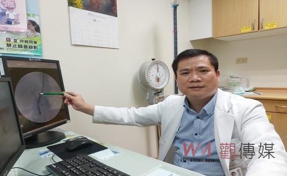 三餐不正常竟變「小小兵」 醫師呼籲:規律進食避免養出結石