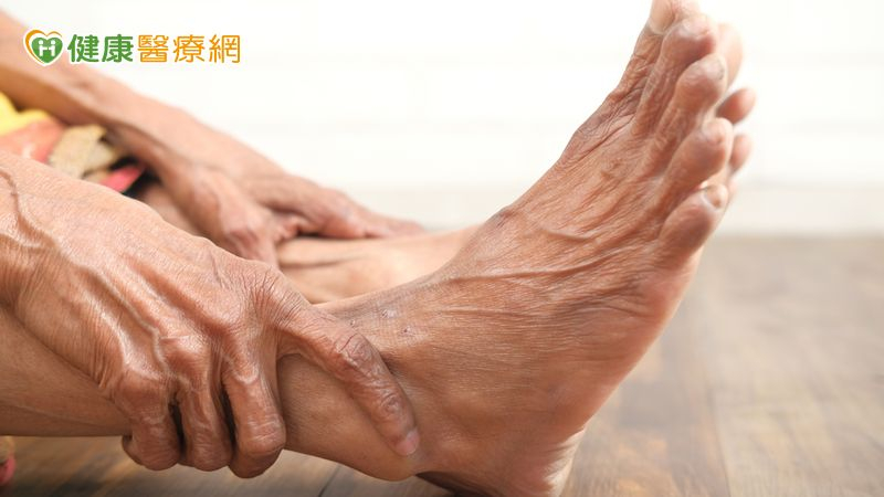 心律不整又「腳中風」 六旬男緊急「取栓」免截肢!