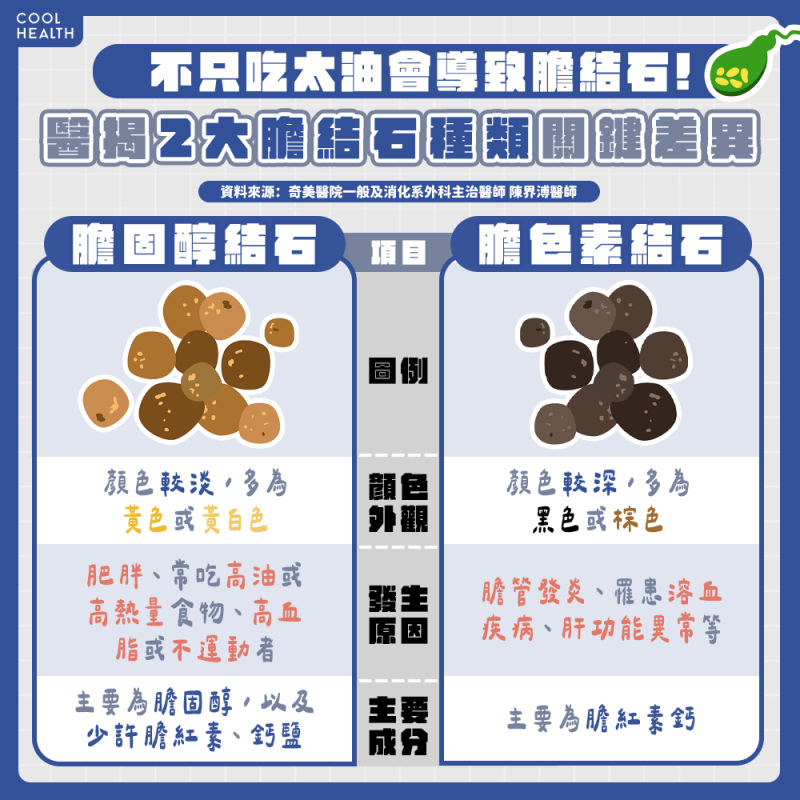 膽結石發生率重女輕男! 年紀越大風險越高不可輕忽