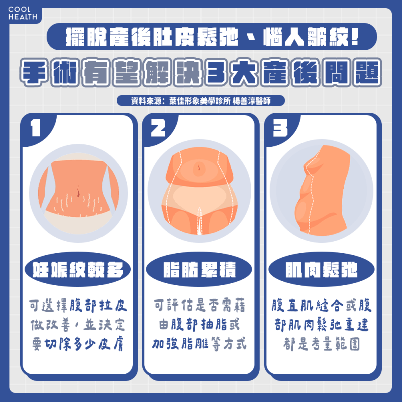 「腹」合式變美法! 助媽咪告別前垮外鬆,重拾有緻曲線