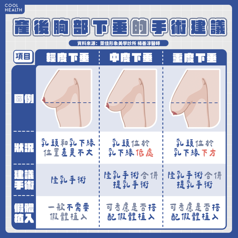擺脫產後肚皮鬆弛 腹部拉皮手術找回緊實小腹