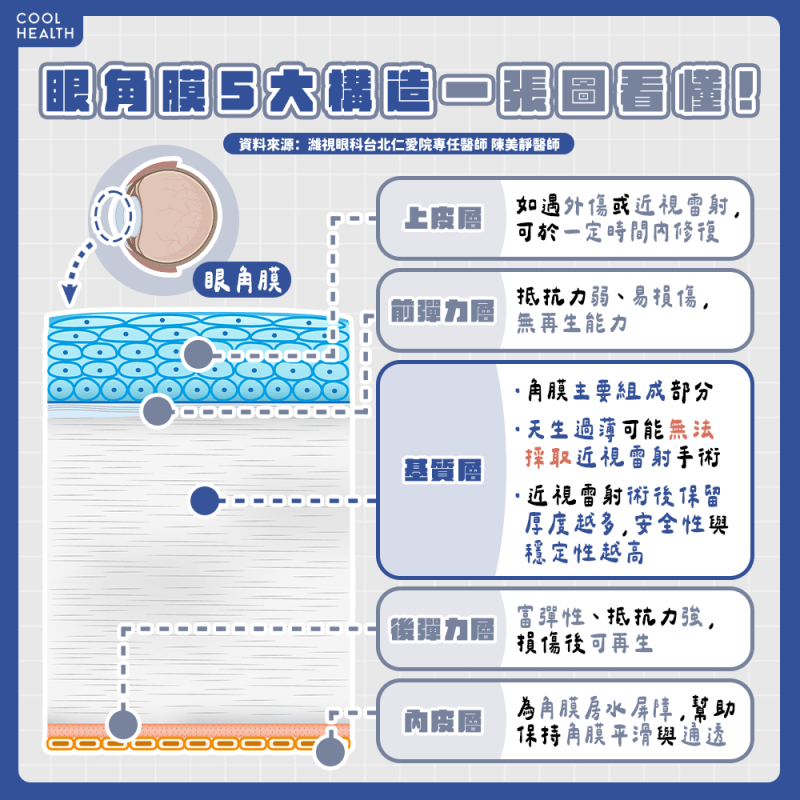 近視雷射不是誰都能做? 眼部「1構造」太薄恐被醫師打槍