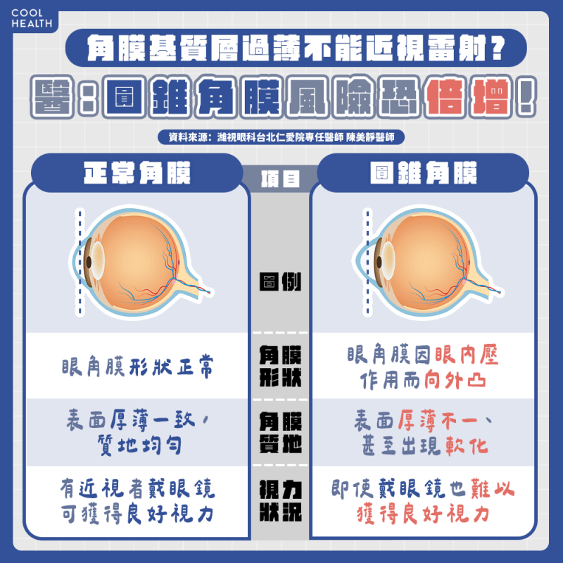 「眼科醫師最不樂見狀況」 角膜剩餘過薄恐引起「圓錐角膜」