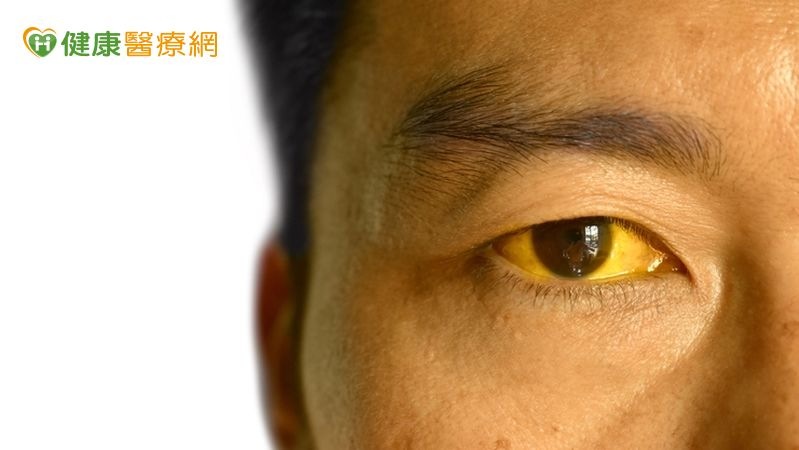 三餐不正常變「小小兵」 醫籲:這樣做避免養出結石