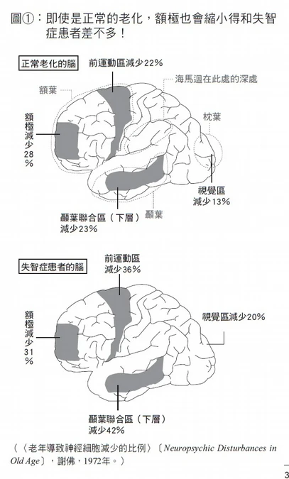 老化腦與失智腦,哪裡不一樣?