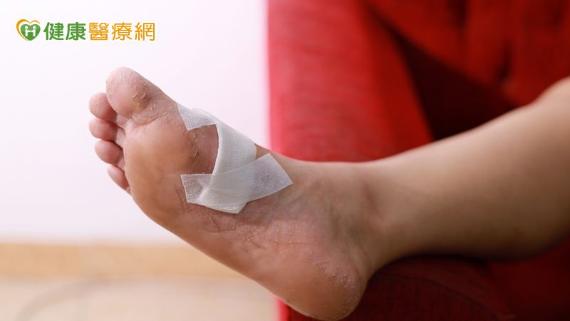 困難傷口難治癒!醫:糖友恐難逃截肢命運 「細胞療法」見效