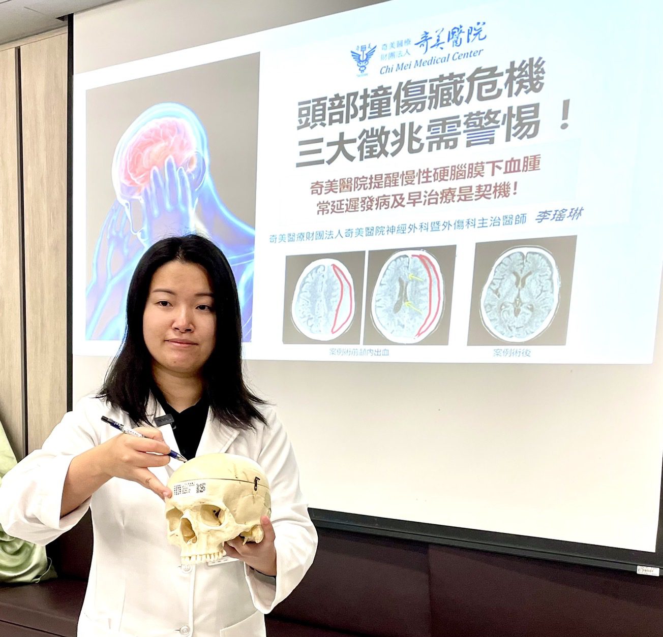 頭部外傷後隱匿危機！「三大徵兆」揪出慢性硬腦膜下血腫風險