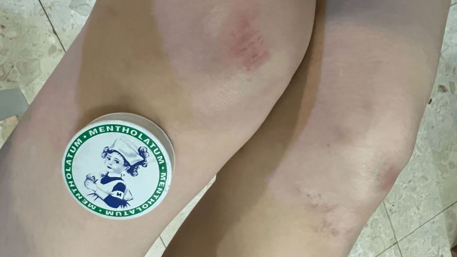 大巨蛋前自行車道民眾44摔 柳采葳轟遠雄雙手一攤不改善 179 照片來源:柳采葳辦公室