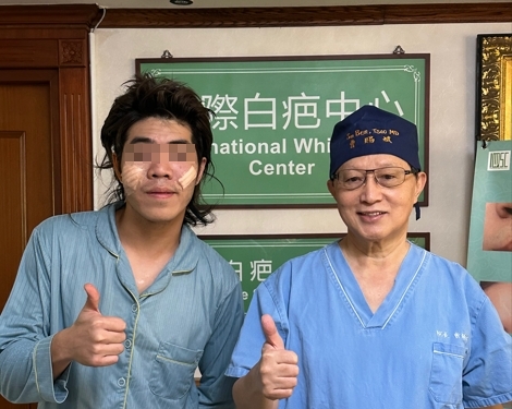 香港酷男雙頰深凹疤「愈補愈大洞」 幸遇台灣醫師撫平 展歡顏