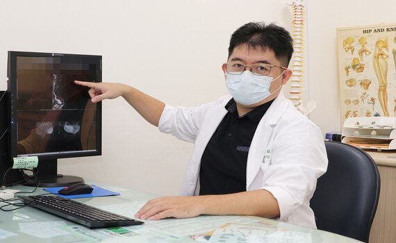 神經外科團隊合作與術中神經監測 迅速摘除脊髓內腫瘤