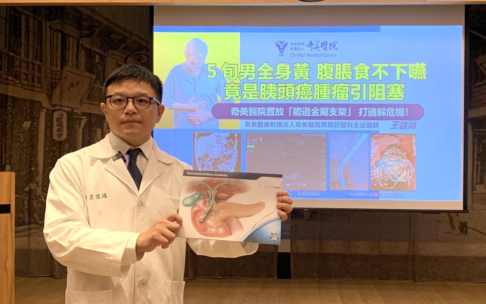 5旬男胰頭癌腫瘤引發膽腸阻塞 「膽道金屬支架」置放手術改善