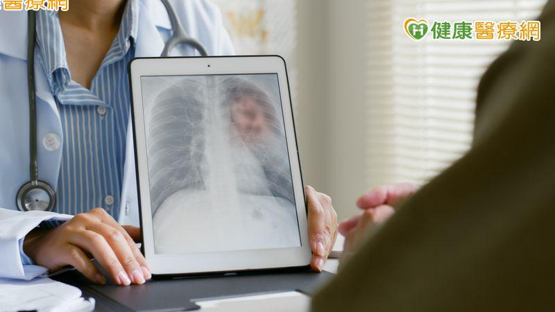 晚期肺腺癌無標靶可用有解! 免疫治療合併抗血管新生拉長存活
