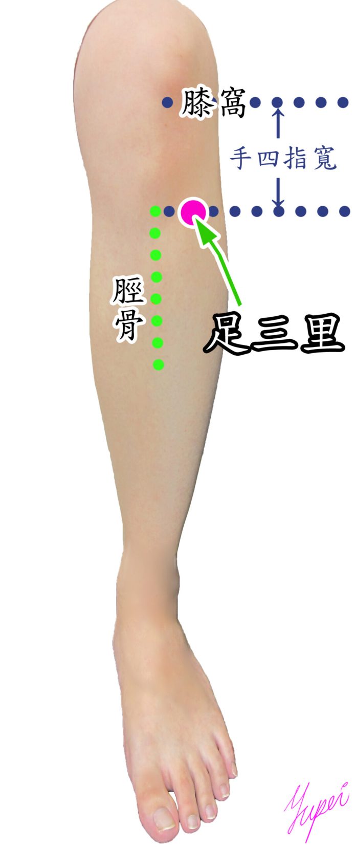 恩主公醫靠這招緩解化療副作用 陪伴病患抗癌 56 緩解癌症化療造成的手腳麻症狀的針灸穴位足三里 scaled