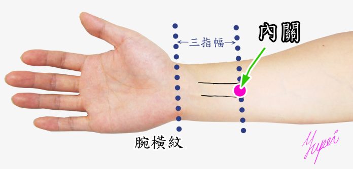 恩主公醫靠這招緩解化療副作用 陪伴病患抗癌 57 緩解癌症化療造成的手腳麻症狀的針灸穴位內關 scaled