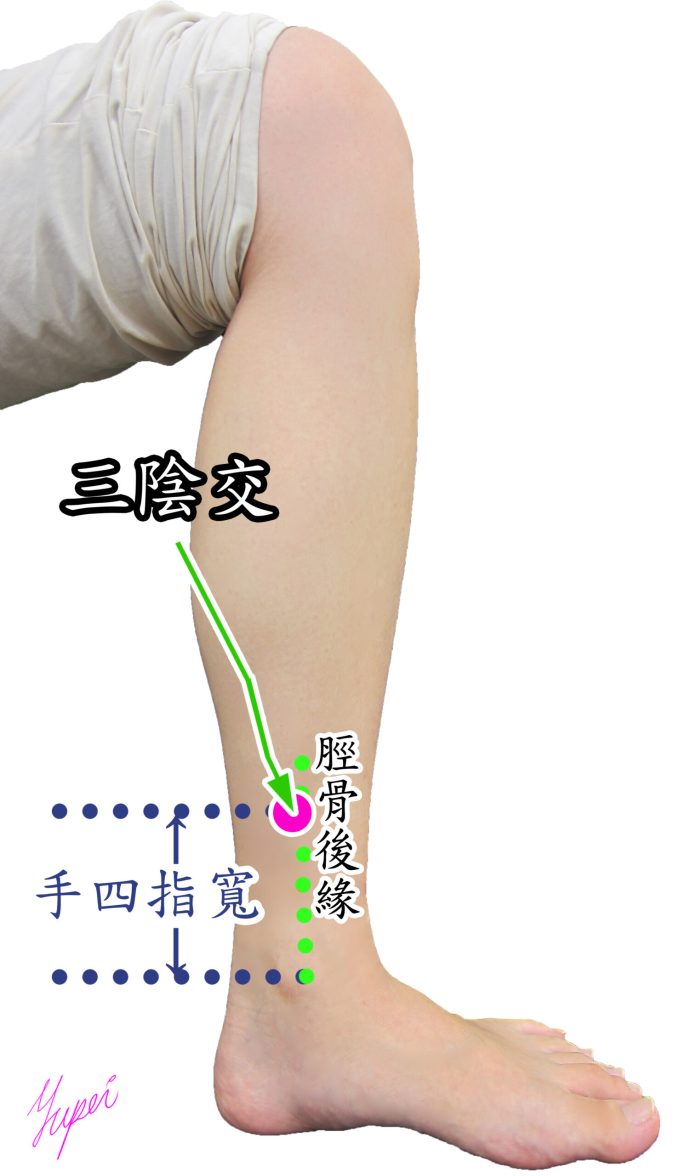 恩主公醫靠這招緩解化療副作用 陪伴病患抗癌 59 緩解癌症化療造成的手腳麻症狀的針灸穴位三陰交 scaled