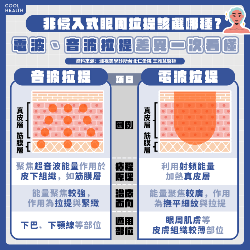 眼周拉提該選電波還是音波? 醫解答:舒適感「它」完勝