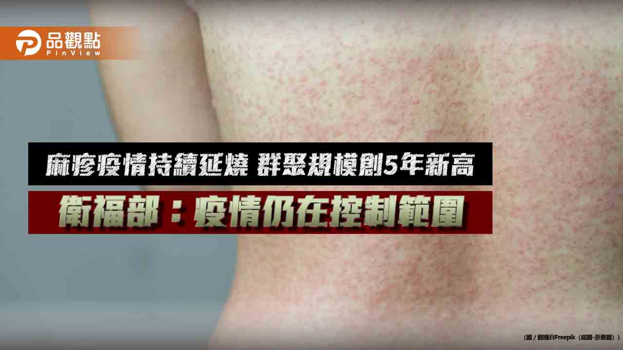麻疹疫情持續延燒 群聚規模創5年新高 衛福部:疫情仍在控制範圍