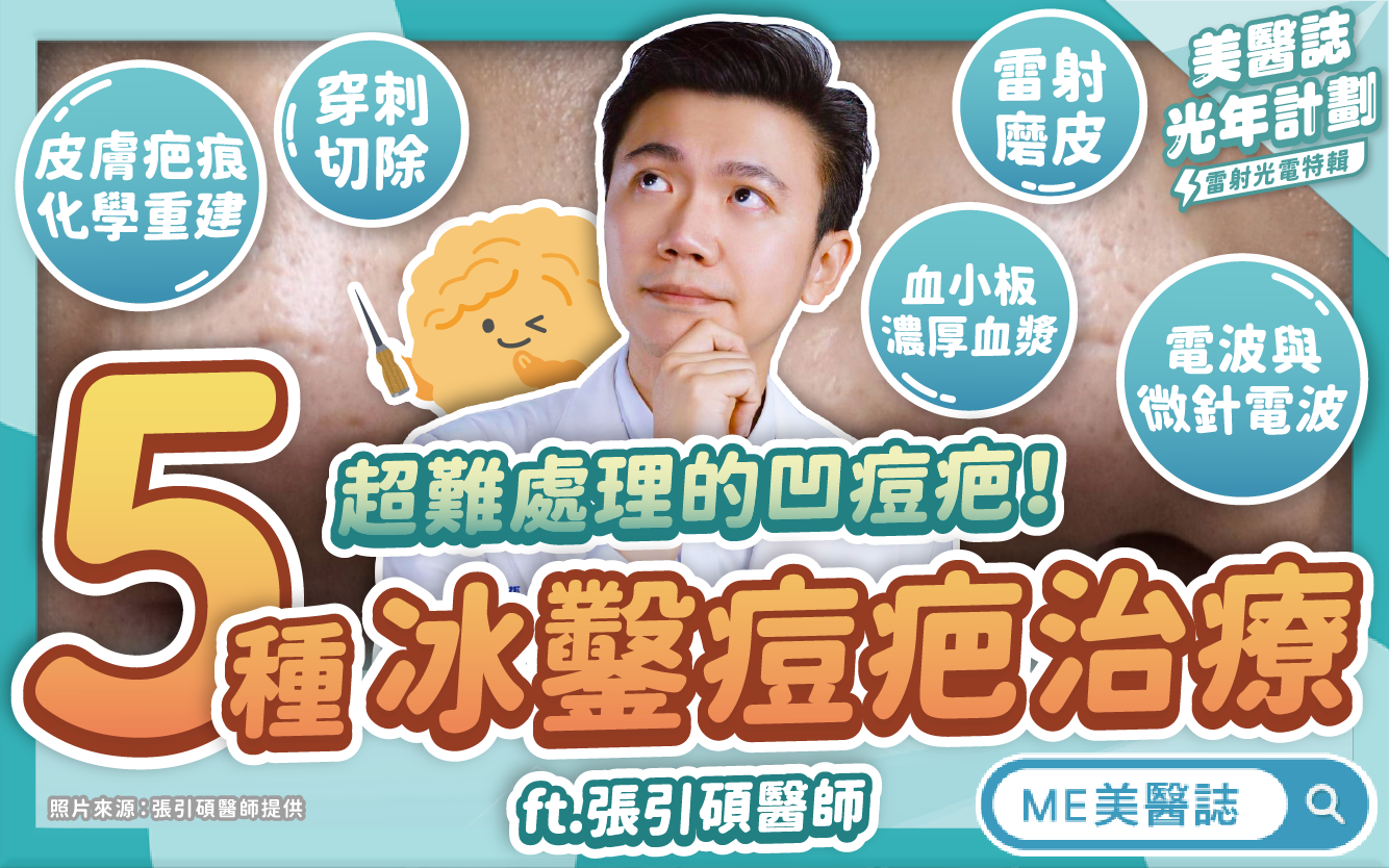 超難治療的冰鑿型痘疤，連雷射磨皮都不一定有用？原來關鍵是要混搭！–名醫問診室｜ME美醫誌