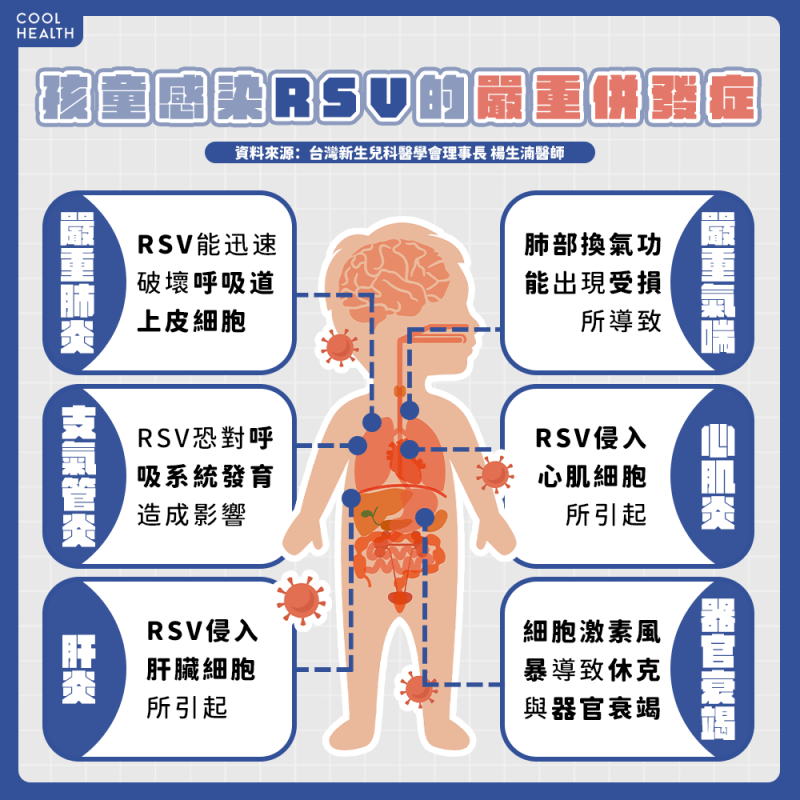 RSV不只是「嚴重一點的感冒」！ 醫：將持續影響孩童呼吸系統