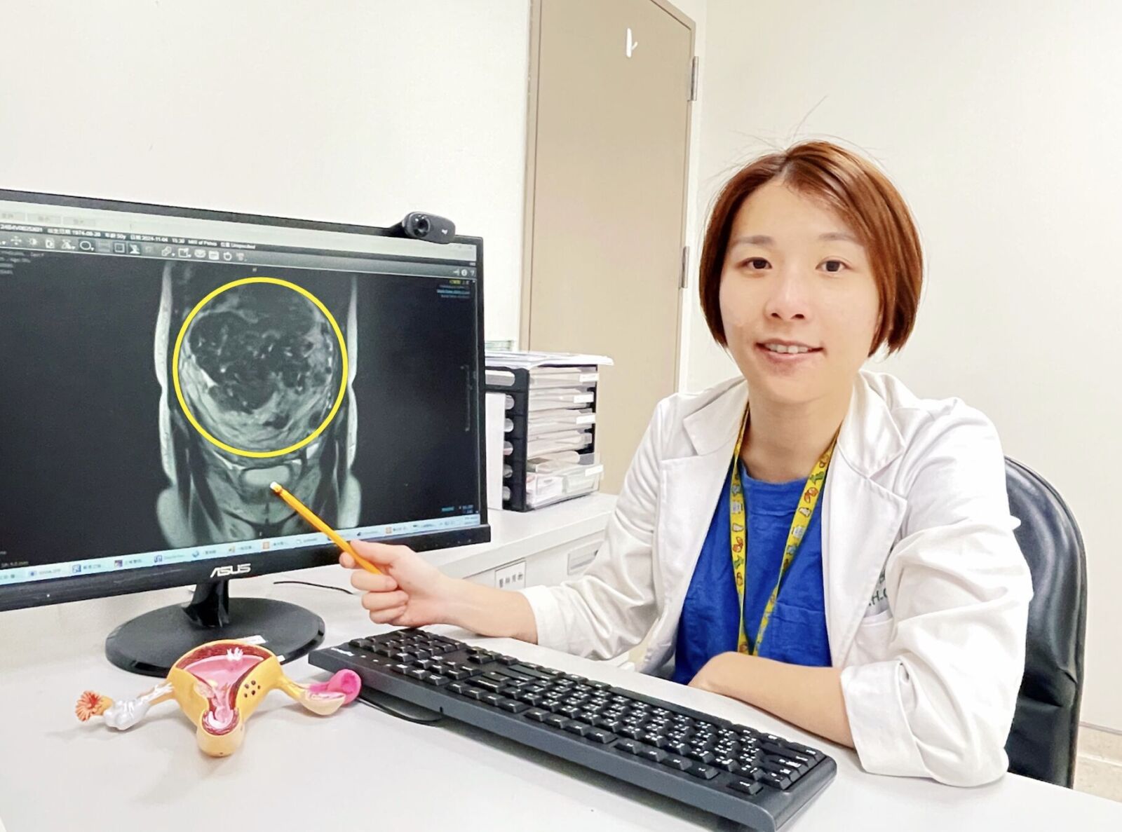 48歲女「小腹一天天隆起」上公車被讓座 不是懷孕!是25公分大肌瘤 256 48歲女「小腹一天天隆起」上公車被讓座 不是懷孕!是25公分大肌瘤 255