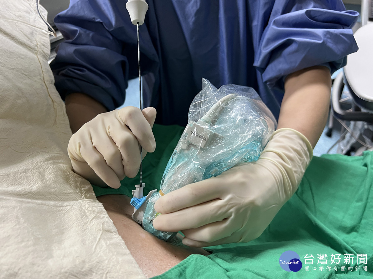 林老先生診斷出肝臟腫瘤,接受消融術成功治癒,順利恢復健康。圖/記者鄧富珍攝