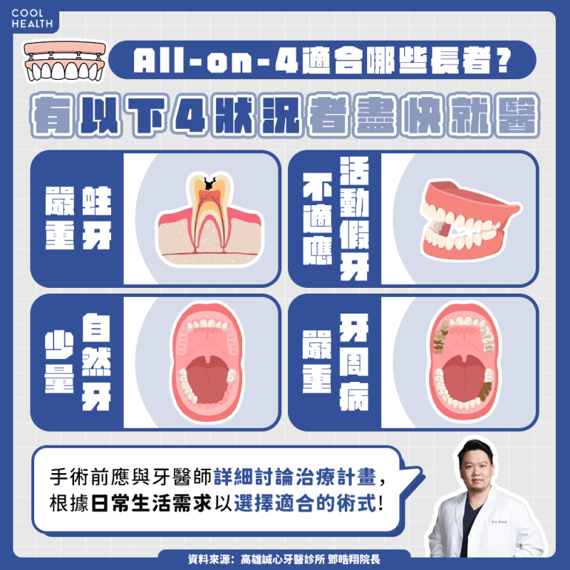 全口重建未必要拔光牙齒?醫:生活品質要納入考量