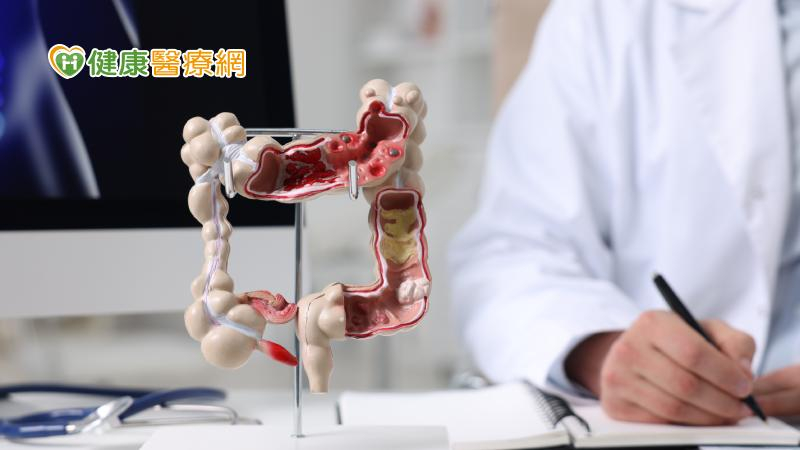 公費大腸癌篩檢對象擴大!新春佳節也要「3多、3少、3去」顧腸道