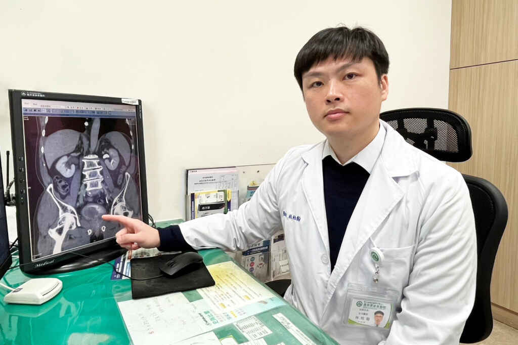 ▲林柏翰醫師指出電腦斷層影像中膀胱異常的病灶位置（手指陰影處），強調早期診斷對降低癌症擴散風險至關重要。（員基醫院提供）