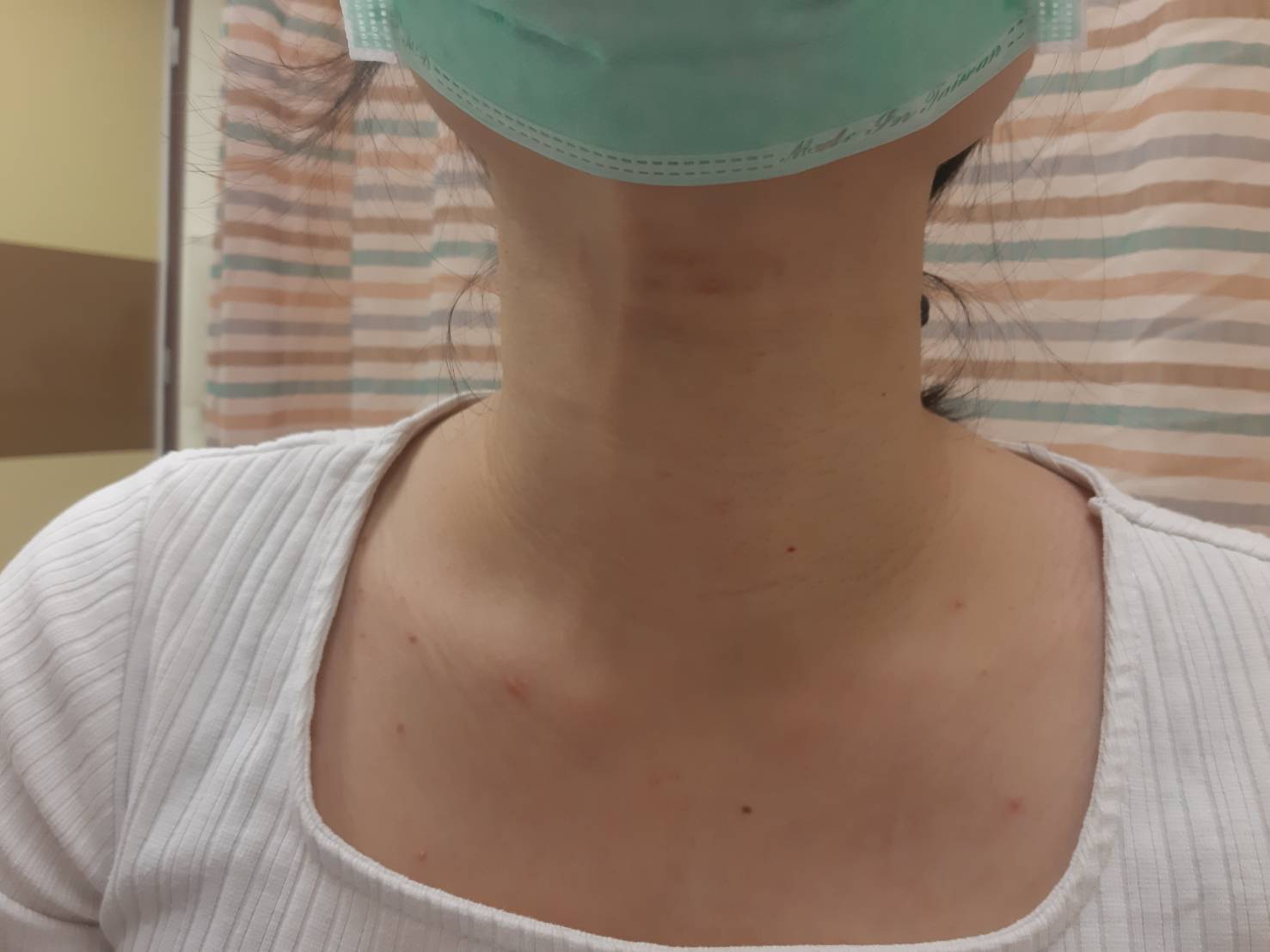 （有影片）／年輕女子飽受甲亢困擾　微創手術助擺脫「大脖子」重拾自信 - https://www.watchmedia01.com