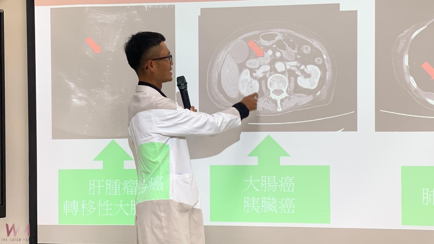 婦人春節期間上吐下瀉不是吃壞肚子 就醫檢查竟是雙癌並存 - https://www.watchmedia01.com