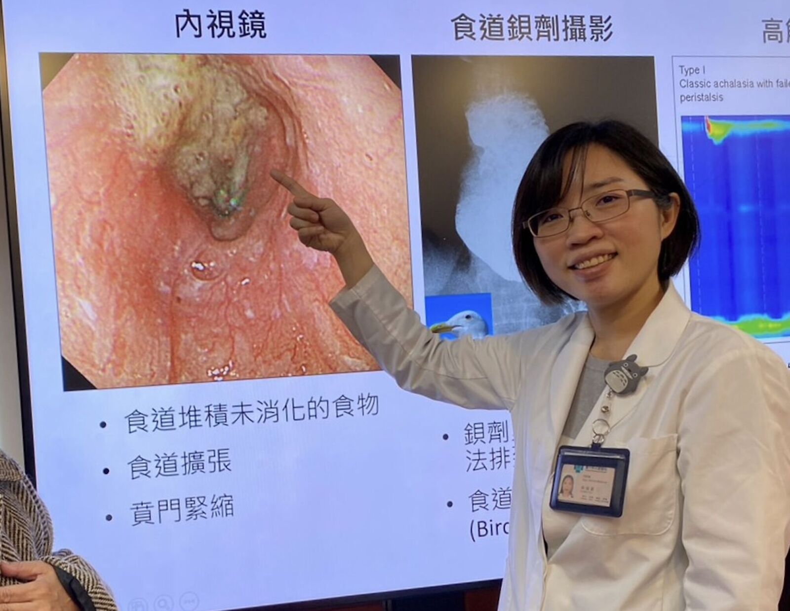 吞嚥困難以為胃食道逆流 她暴瘦21公斤!竟是發生率十萬分之一難纏病 216 吞嚥困難以為胃食道逆流 她暴瘦21公斤!竟是發生率十萬分之一難纏病 215
