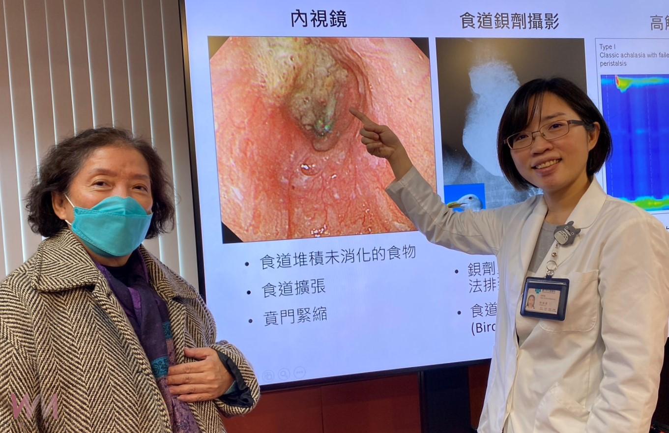 嬤吞嚥困難暴瘦21公斤！食道肌肉緊繃　中榮醫：內視鏡技術 恢復正常飲食