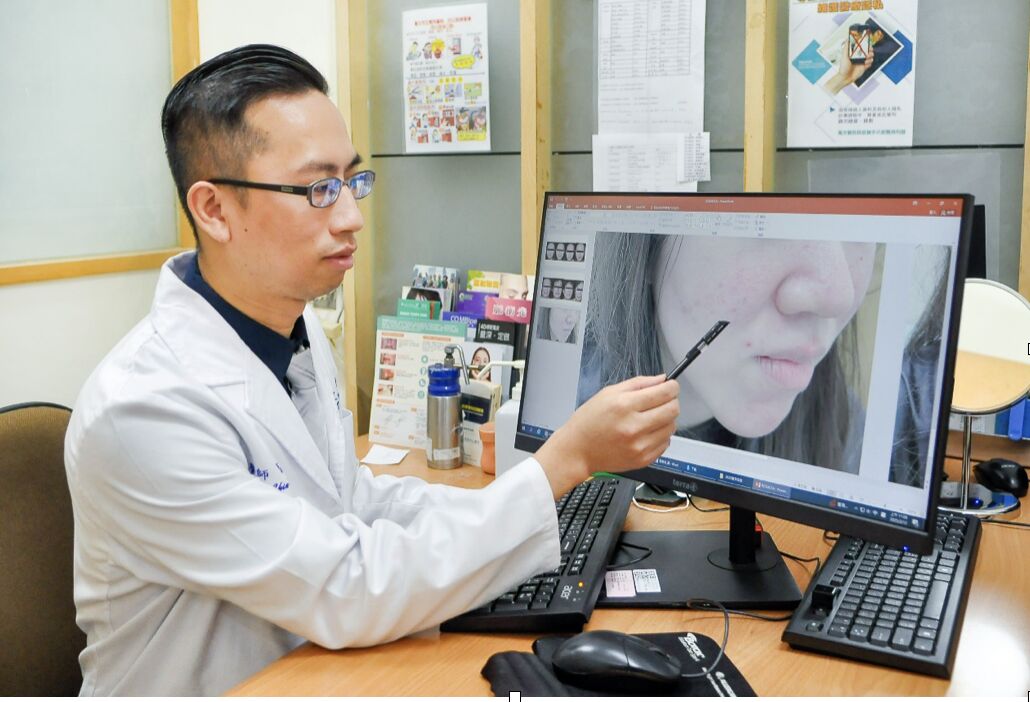 長痘就是青春痘? 30歲女總是「臉很紅」其實玫瑰斑 250 長痘就是青春痘? 30歲女總是「臉很紅」其實玫瑰斑 249