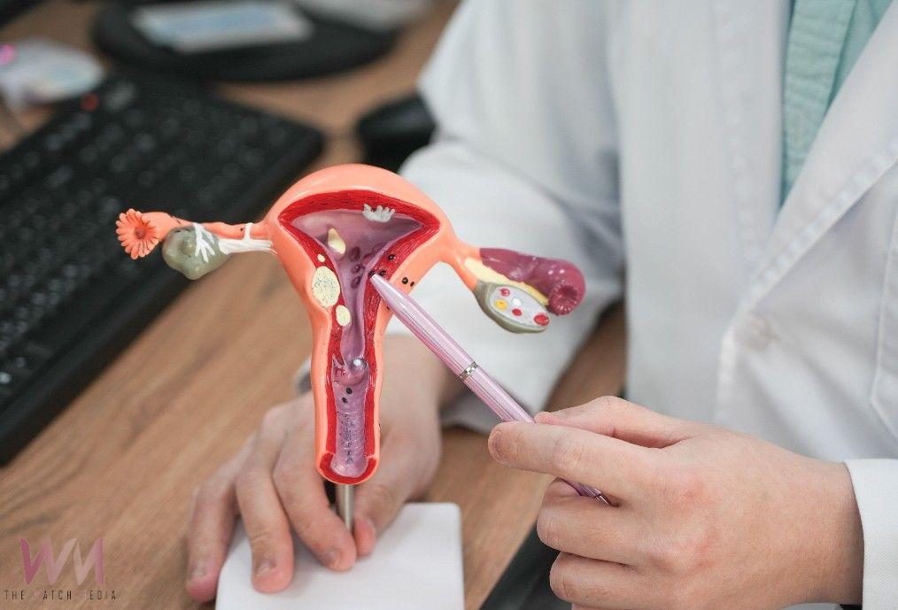 6旬婦人腹部隆起如懷孕　原來是「子宮內避孕器」惹禍 - https://www.watchmedia01.com