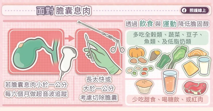 面對膽囊息肉