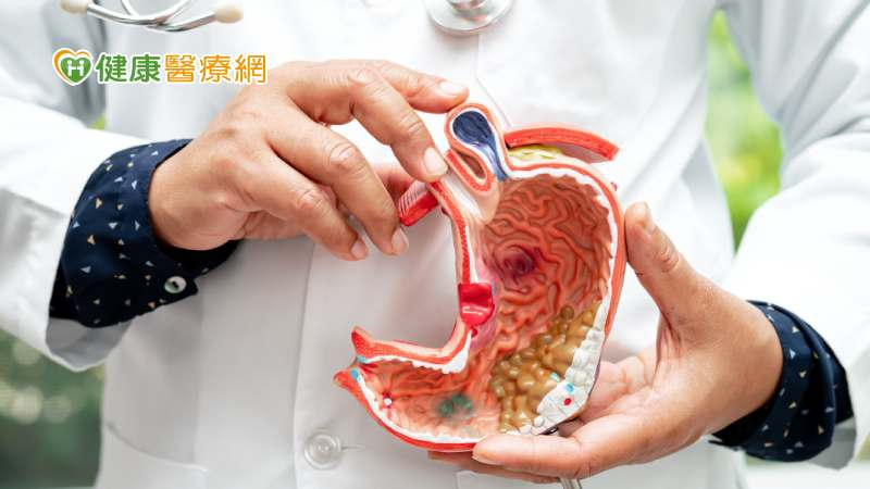 胃癌約9成是「幽門桿菌」所致!護胃健康有5招 今年篩檢擴大試辦17縣市