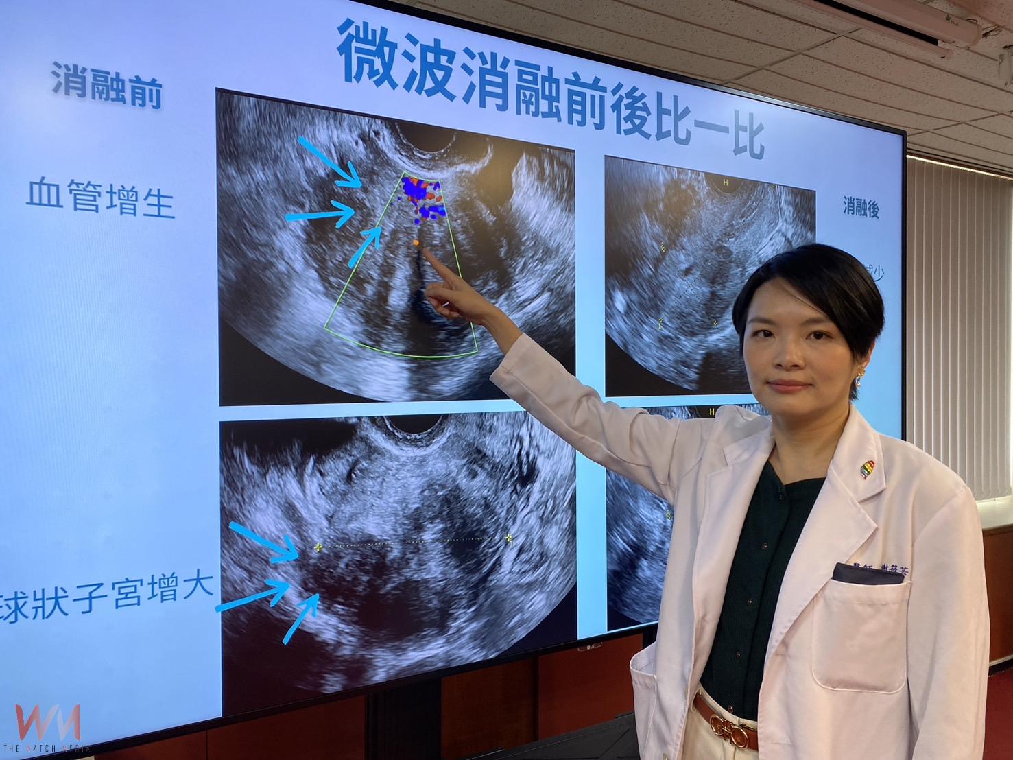 助女性擺脫經痛困擾!微波消融術改寫腺肌症命運 重獲無藥無痛人生 - https://www.watchmedia01.com