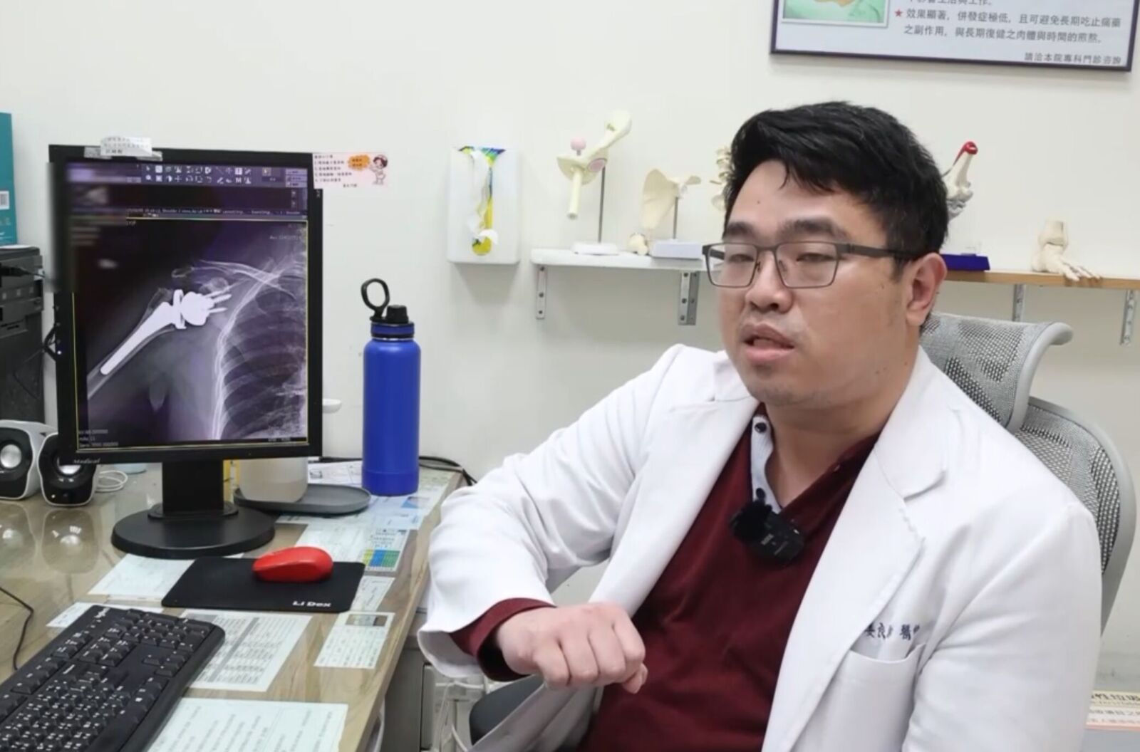 肩膀不適變大事!她痛到無法脫褲如廁 竟已肌腱斷裂+肱骨壞死 214 肩膀不適變大事!她痛到無法脫褲如廁 竟已肌腱斷裂+肱骨壞死 213