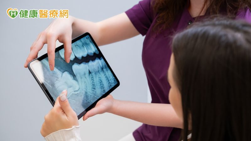 害怕拔牙後塌陷無法植牙? 「1新技術」助重建健康咬合更成功