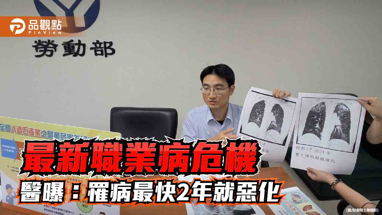 最新職業病危機 醫曝這產業罹病最快2年就惡化